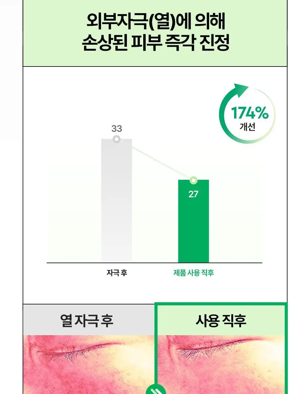 [밀착진정] 듀이트리 AC 딥 진정 마스크 1매 (열감/흔적) 상세페이지 72